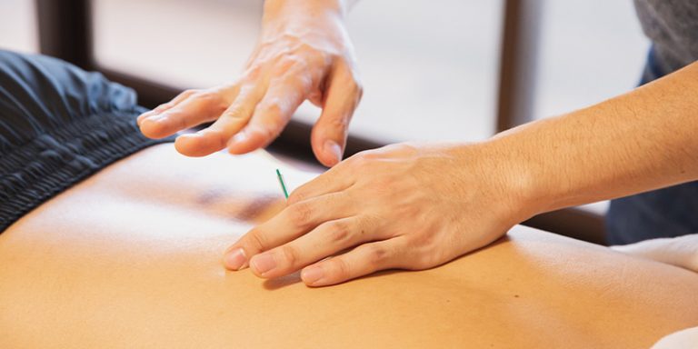 طب سوزنی چیست و چه بیماریهایی را درمان میکند