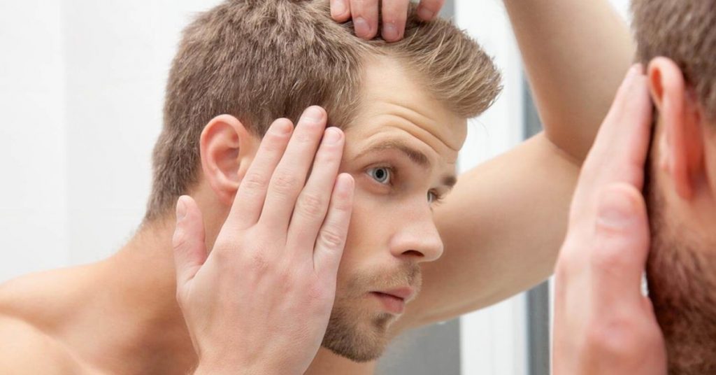 قرص آیزن پلاس برای ریزش مو