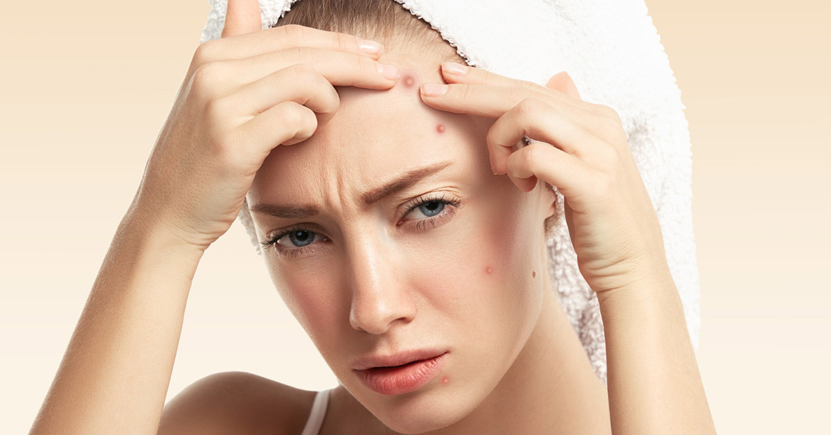 اسپری نیواشا برای جوش و آکنه