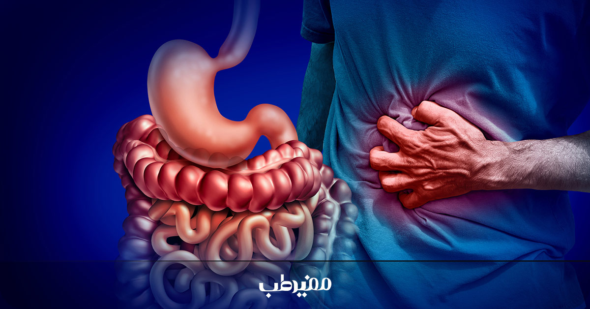 یبوست مزمن و طولانی مدت