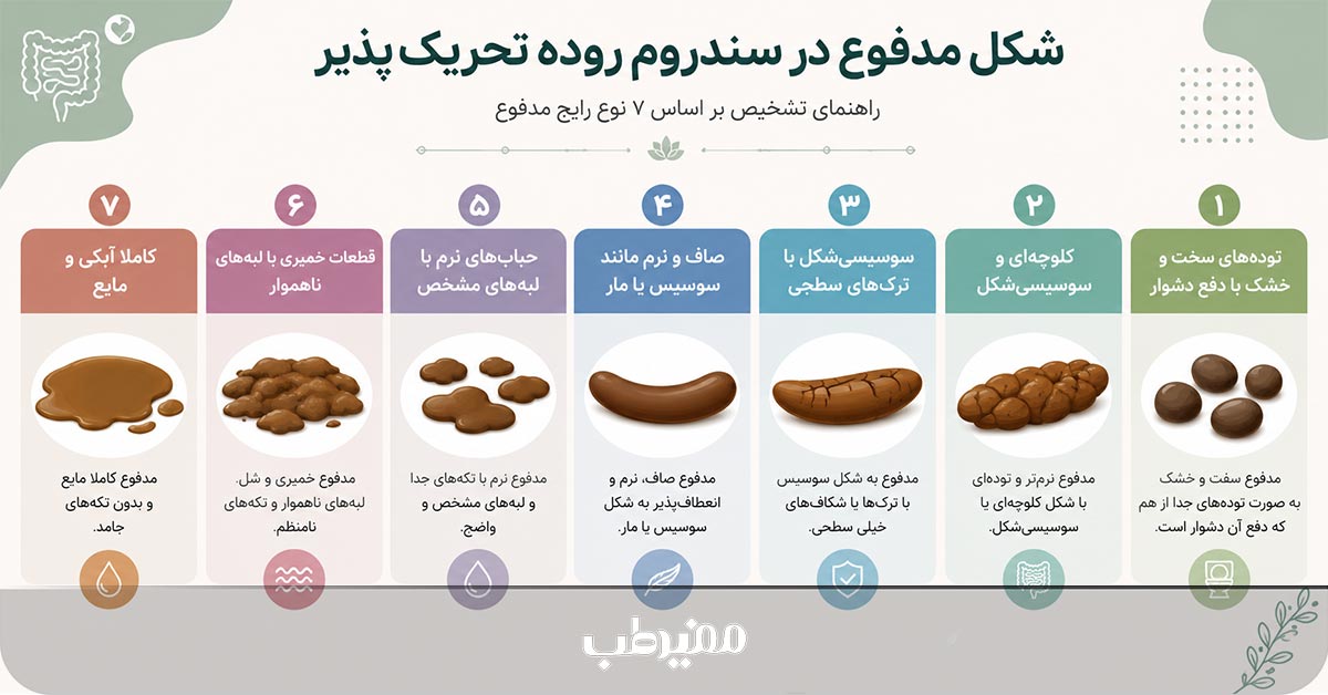 شکل مدفوع در سندروم روده تحریکپذیر