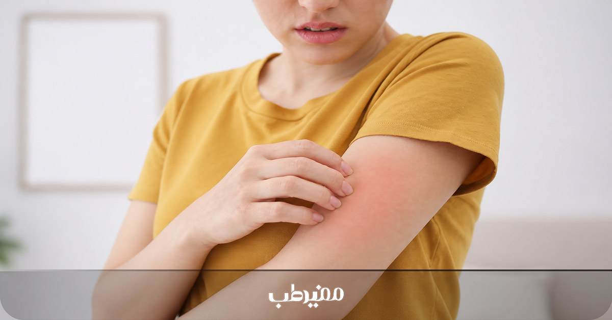 واکنش آلرژیک احتمالی به قرص دایمولاکس